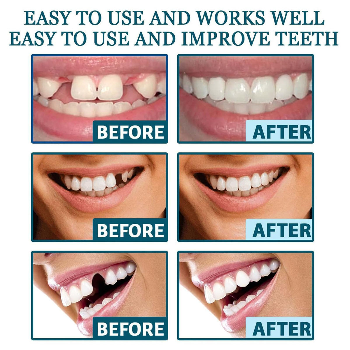 Clip on Veneers Silicone Kit for Both Upper and Lower (3Set) W6955